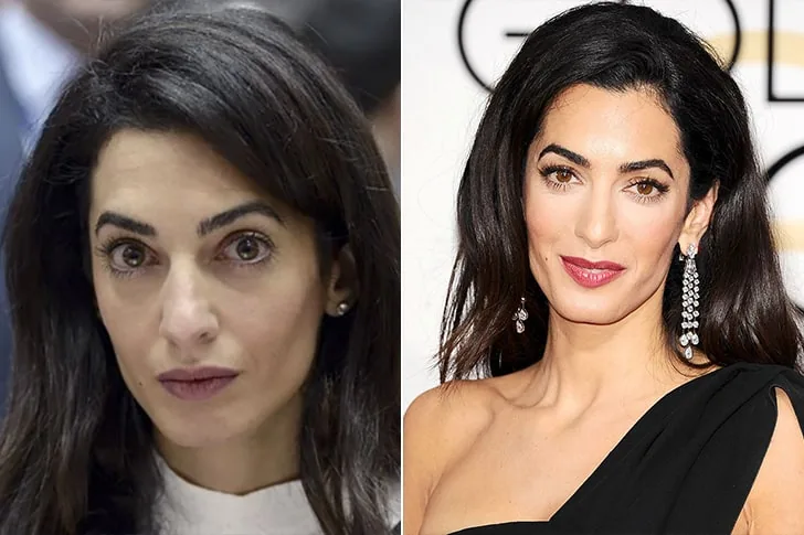 Amal Clooney
