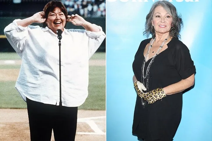 Roseanne Barr – intervento chirurgico