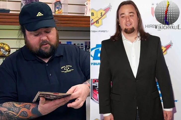 Austin “Chumlee” Russel – Bendaggio gastrico