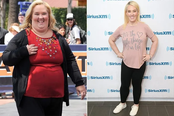 Mama June – Chirurgia bariatrica