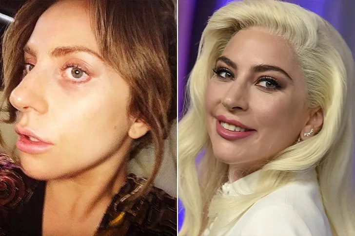 Lady Gaga