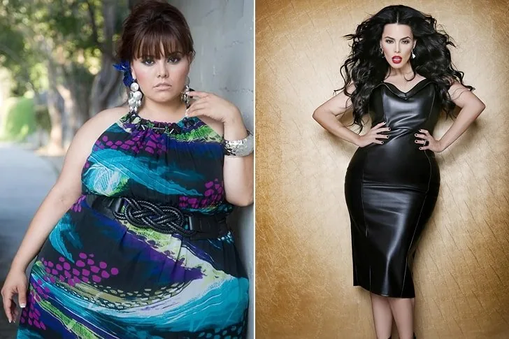 Rosie Mercado – Chirurgia bariatrica e dieta