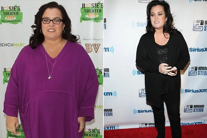 Rosie O’Donnell – Bypass gastrico