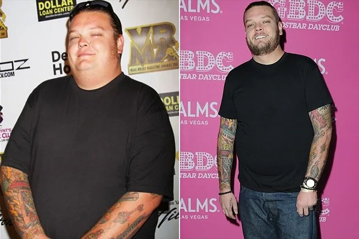 Corey Harrison – Bendaggio gastrico