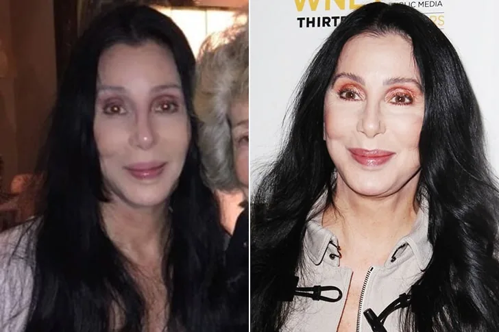 Cher