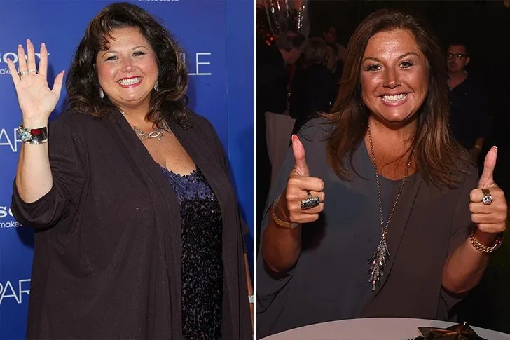 Abby Lee Miller – Chirurgia bariatrica